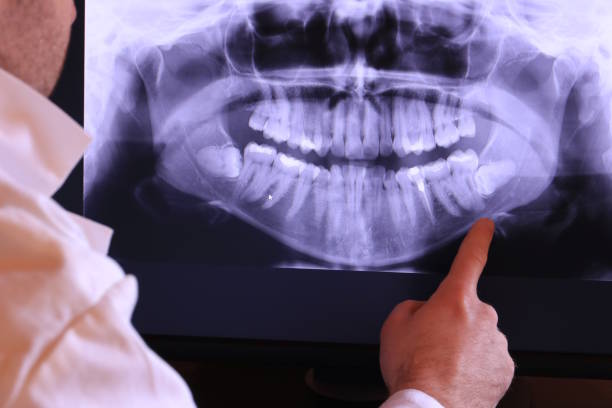 Best Dentist for Tooth Abscess  in Onawa, IA